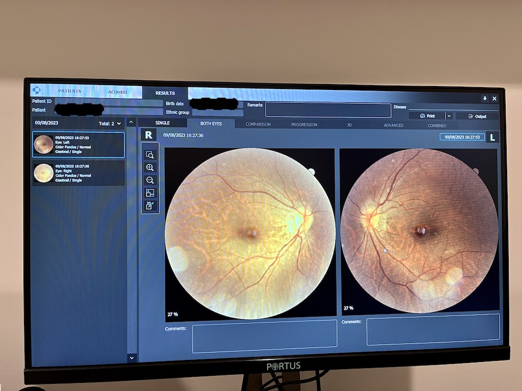 My First Eye Test in the UK (Free vs Paid Explained)